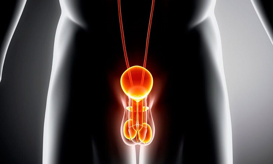prostatit için iltihaplı genitoüriner sistem